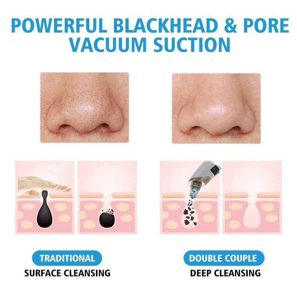 Portable Blackhead Pore Cleaner